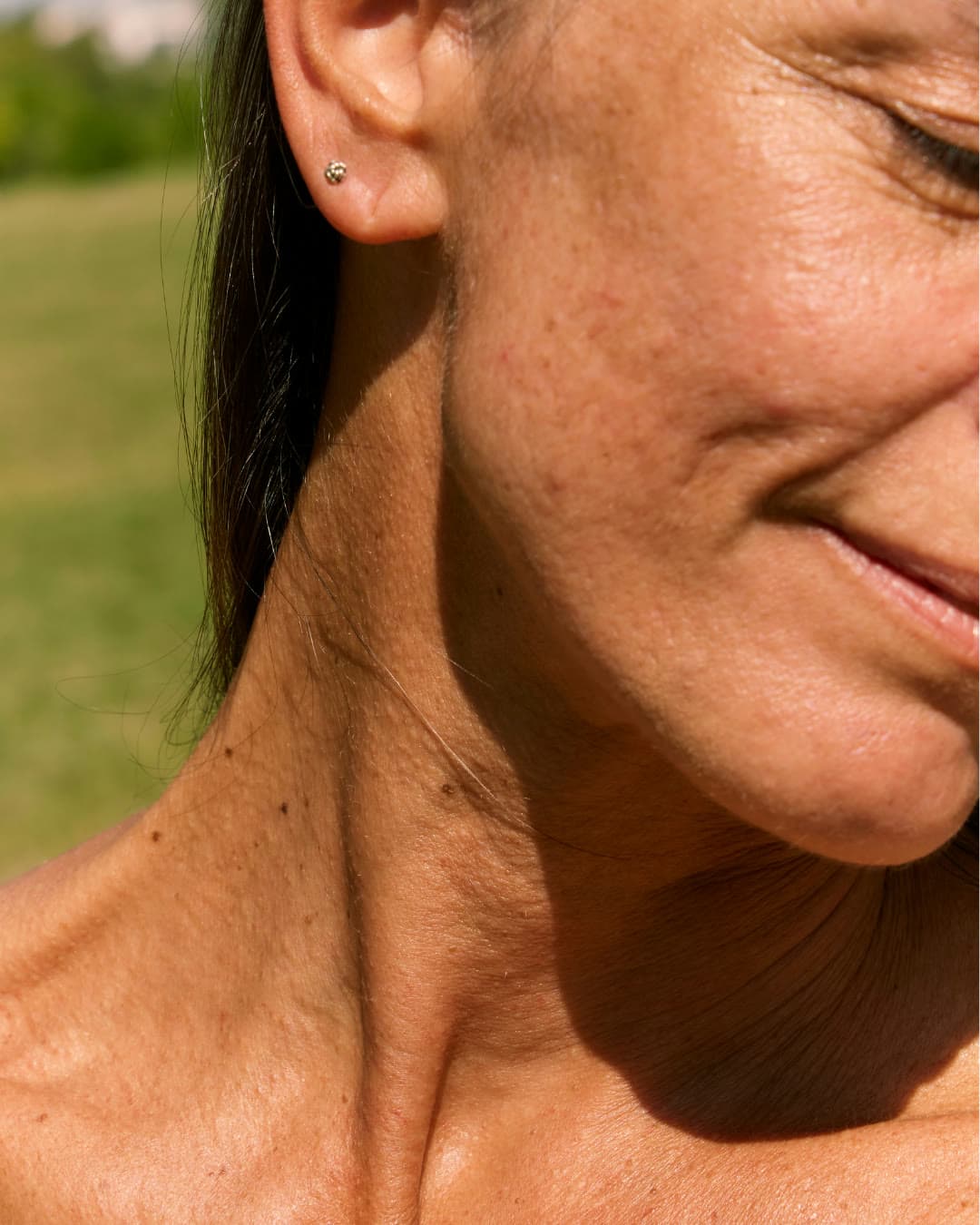 Aged Skin treatment at Dr Alexa, Mayfair London