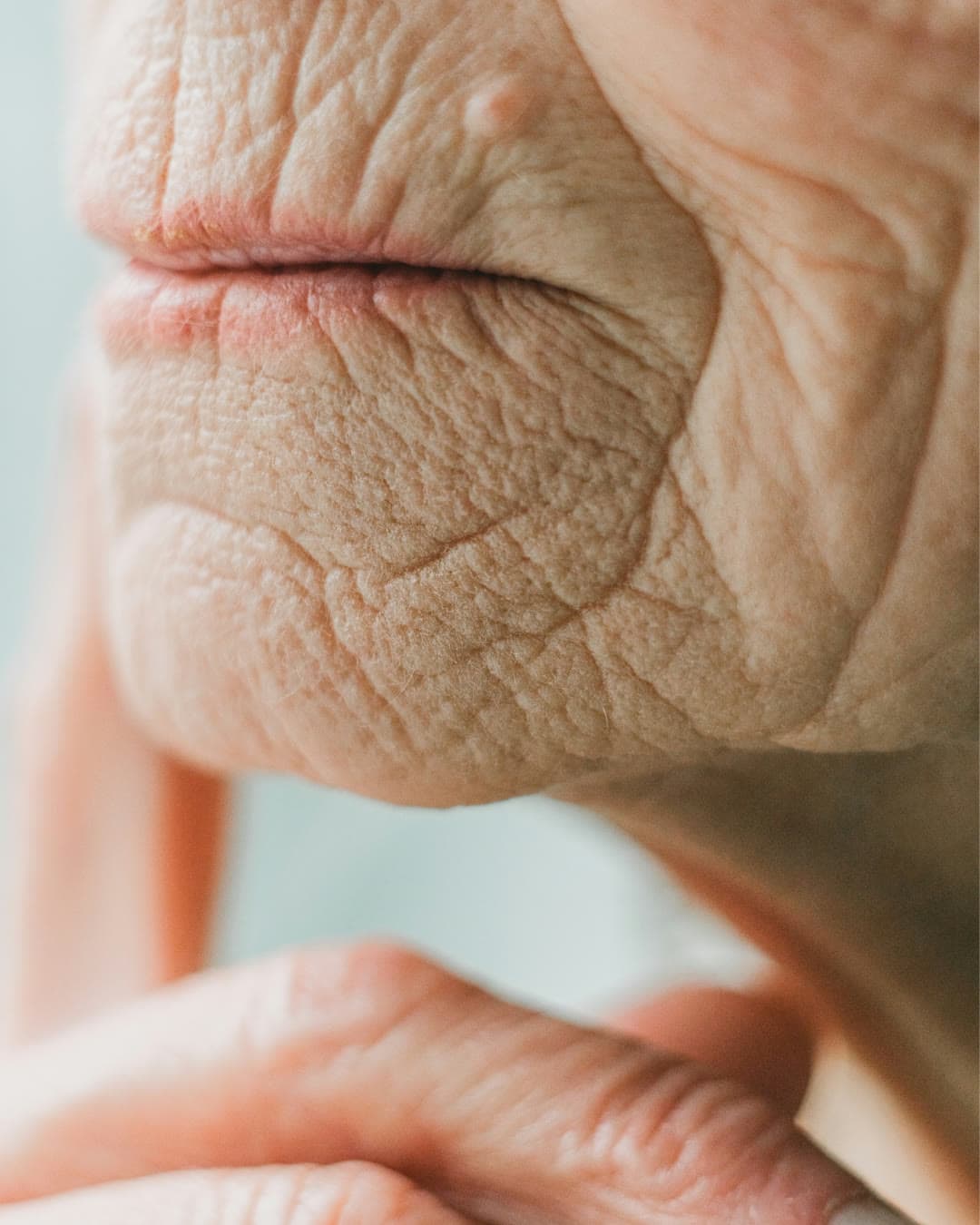 Aged Skin concern — Dr Alexa aesthetic clinic London