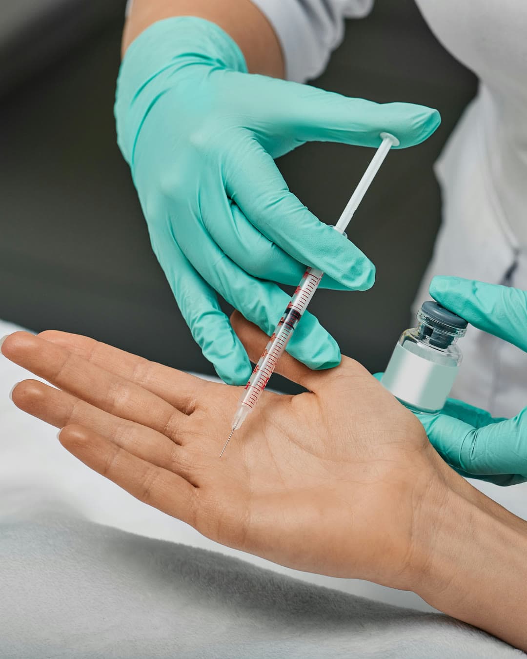 Excessive Sweating concern — Dr Alexa aesthetic clinic London