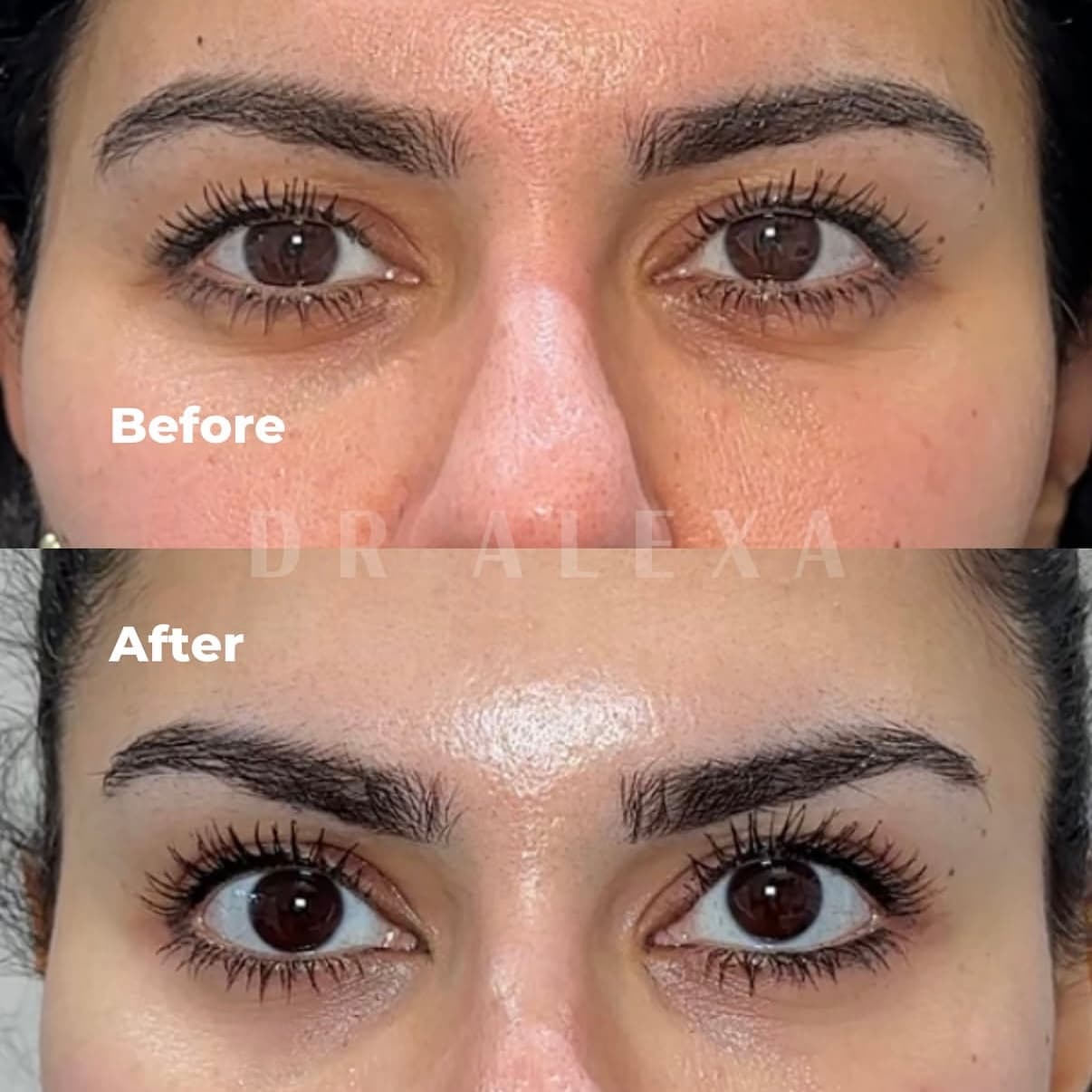 Dr Alexa Instagram post 3 — aesthetic clinic Mayfair London