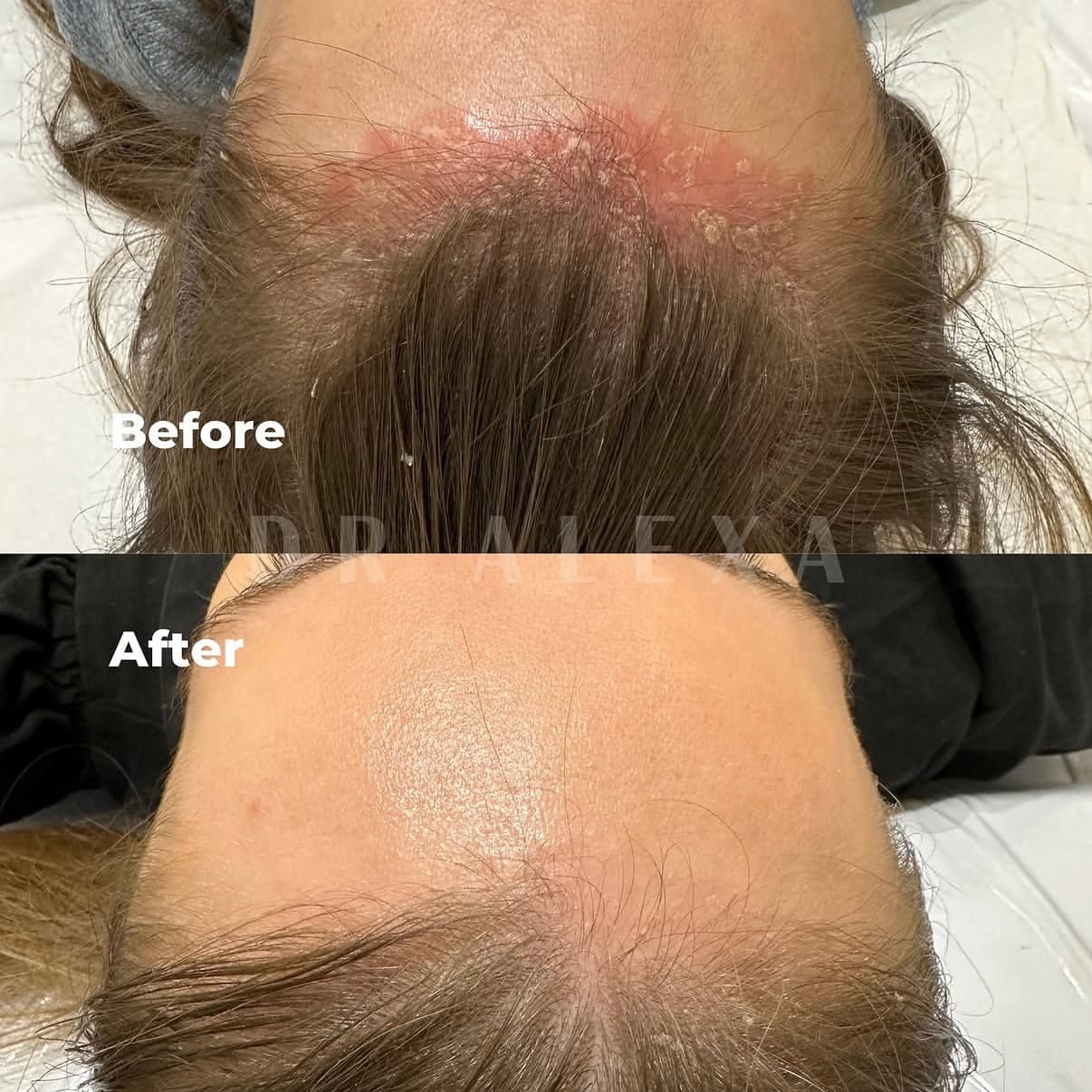 Dr Alexa Instagram post 4 — aesthetic clinic Mayfair London