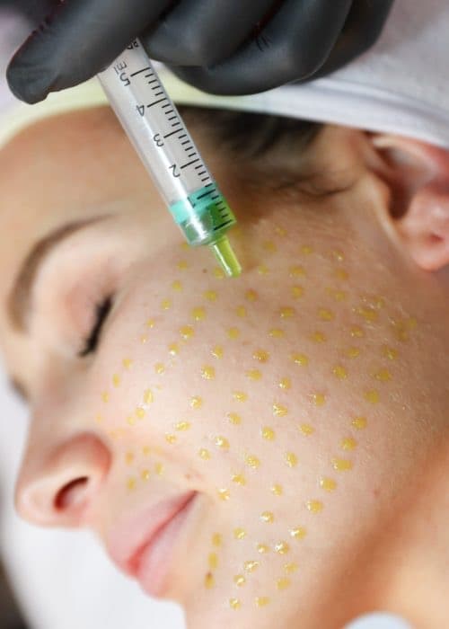 BioRePeel at Dr Alexa, Mayfair London — clinic photo 2