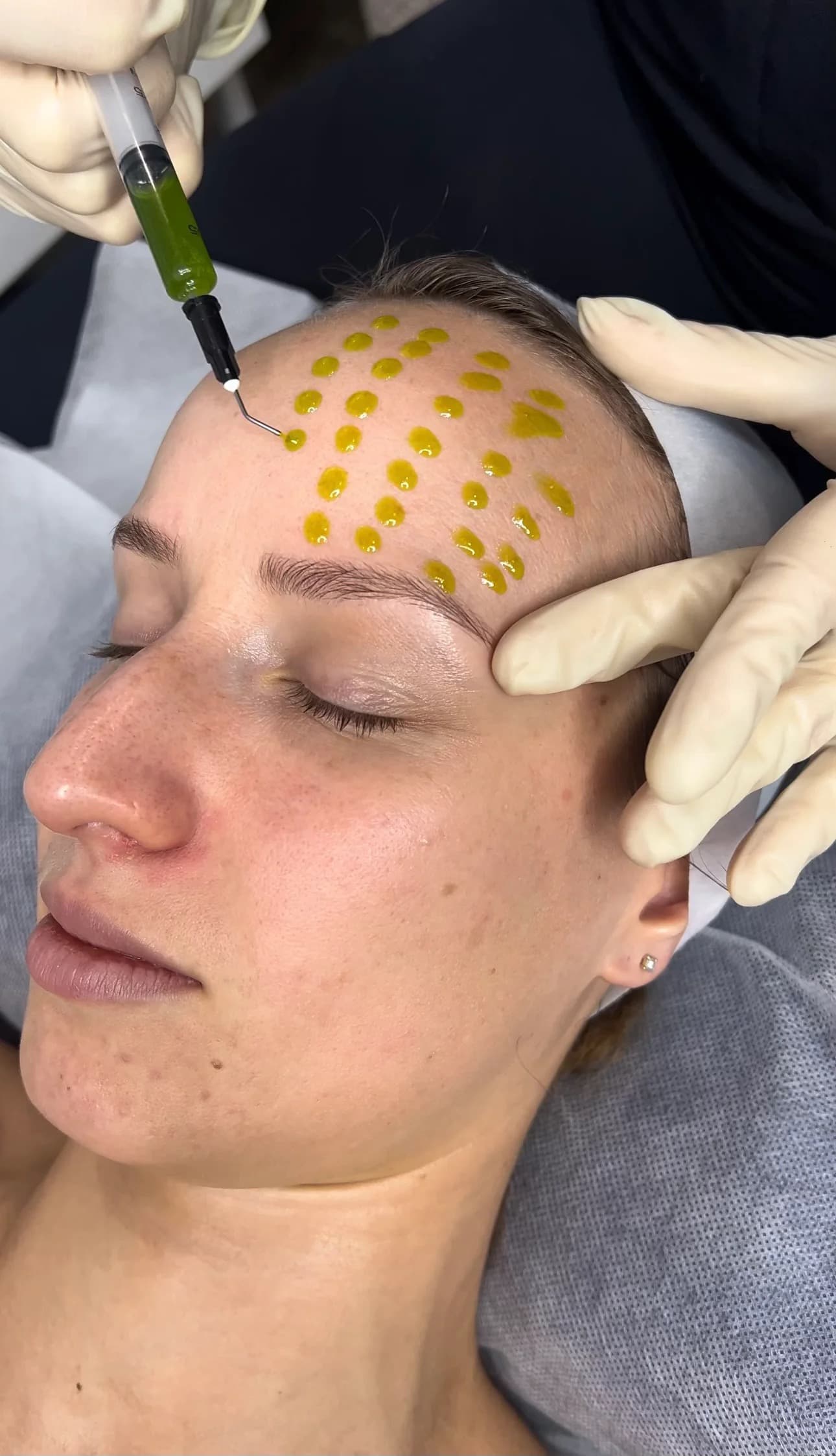 BioRePeel at Dr Alexa, Mayfair London — clinic photo 3