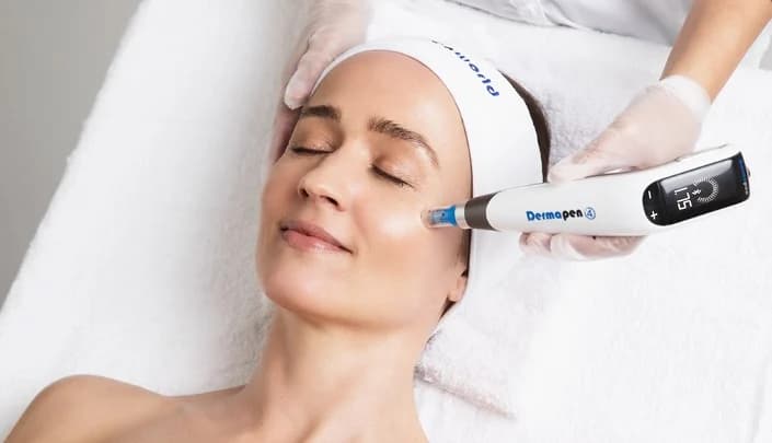 Dermapen Microneedling for Enlarged Pores at Dr Alexa, London