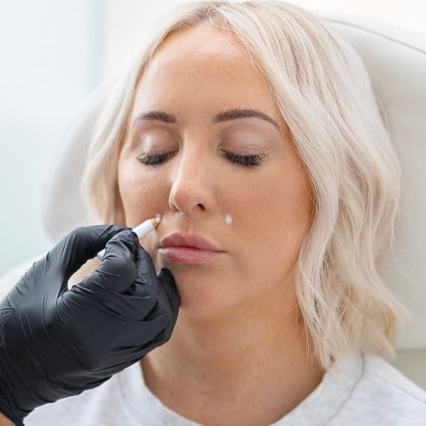 Gummy Smile London Mayfair — doctor-led aesthetic treatment at Dr Alexa