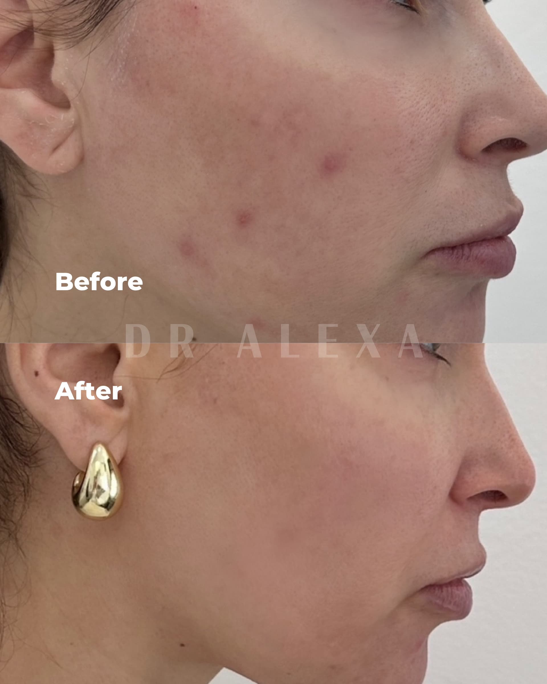 Polynucleotides before and after — case 3, Dr Alexa Mayfair