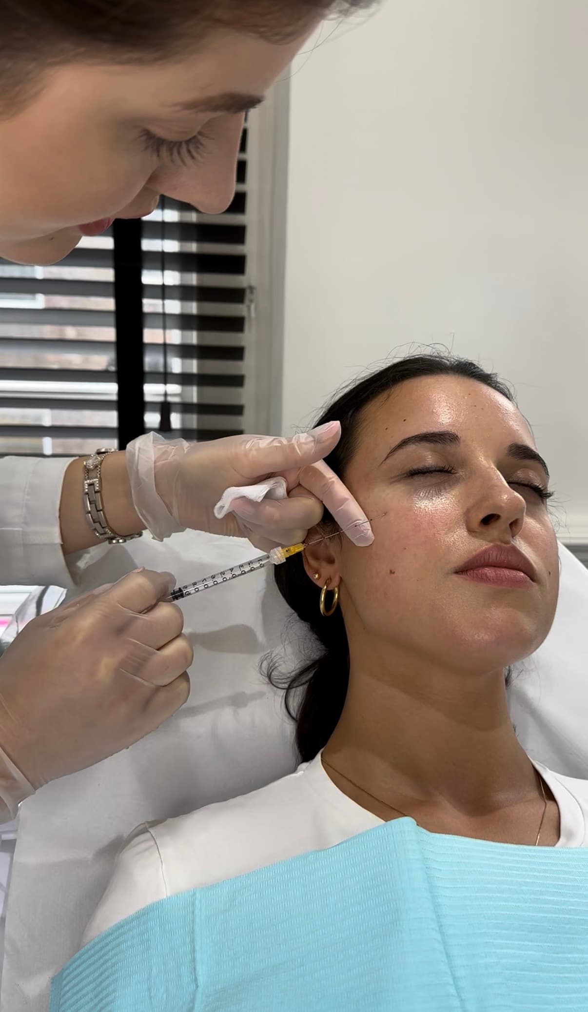 SuneKos treatment at Dr Alexa, Mayfair London
