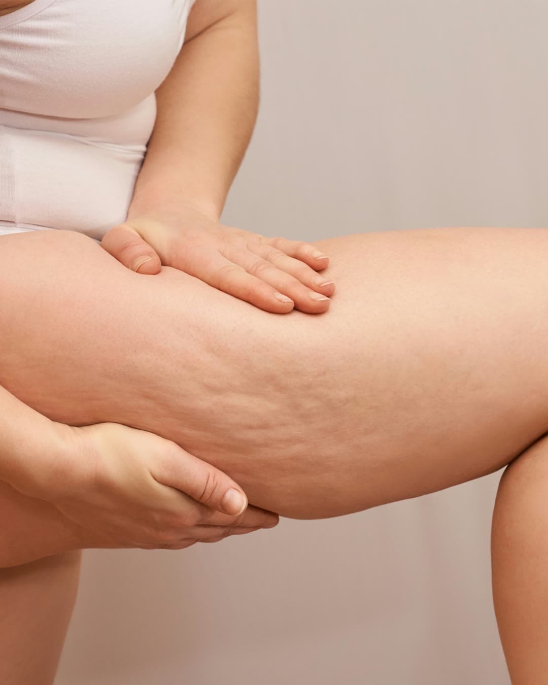 Cellulite treatment at Dr Alexa, Mayfair London