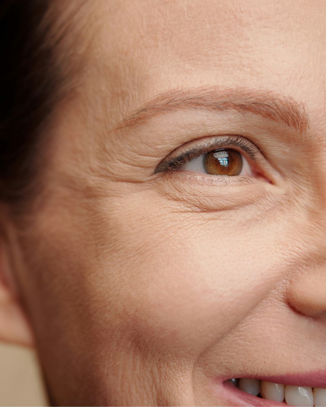 Lines and Wrinkles treatment at Dr Alexa, Mayfair London