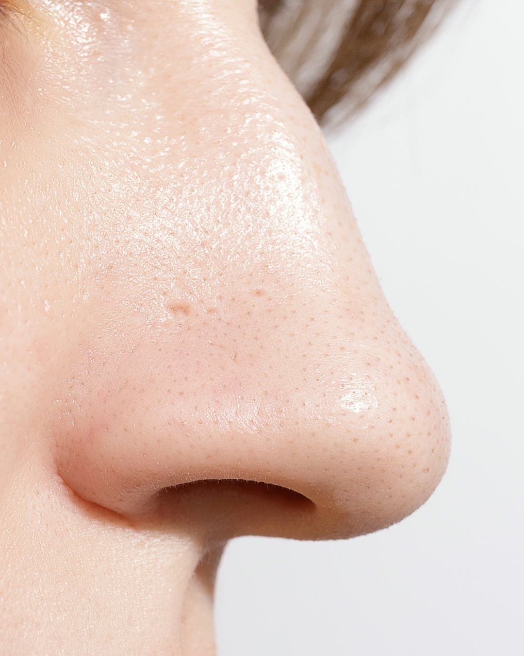 Nose Shape treatment at Dr Alexa, Mayfair London