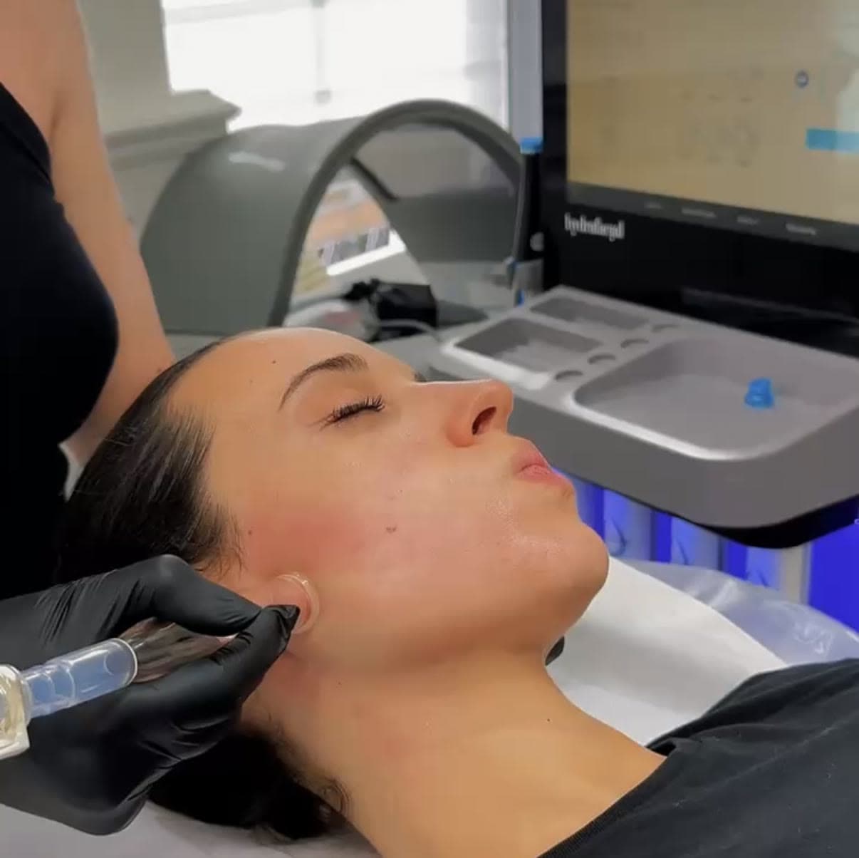HydraFacial London Mayfair — doctor-led aesthetic treatment at Dr Alexa