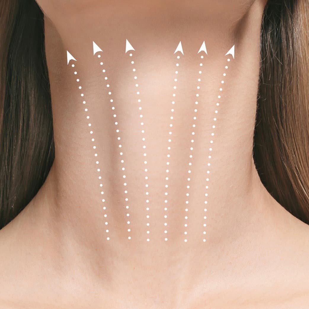 Nefertiti Neck Lift treatment at Dr Alexa, Mayfair London