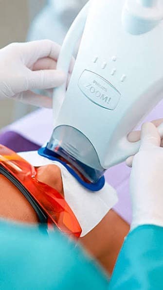 Philips ZOOM Teeth Whitening treatment at Dr Alexa, Mayfair London